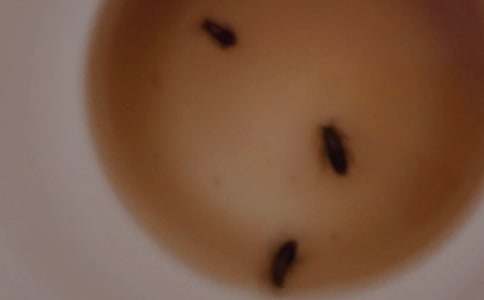 梦见蟑螂爬到身上打死